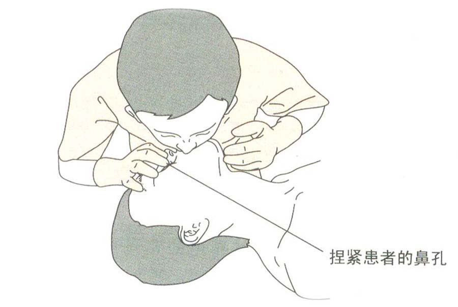 如何进行人工呼吸