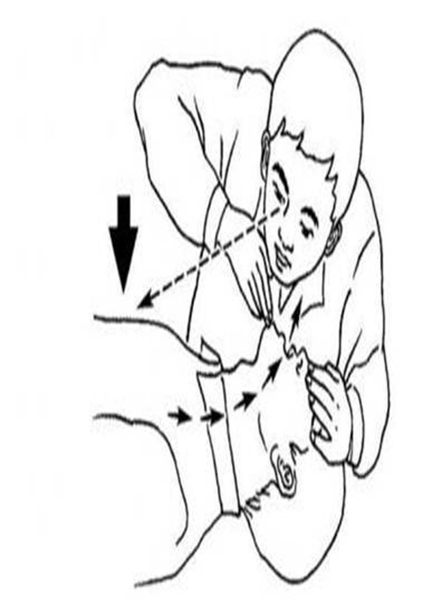 如何进行人工呼吸